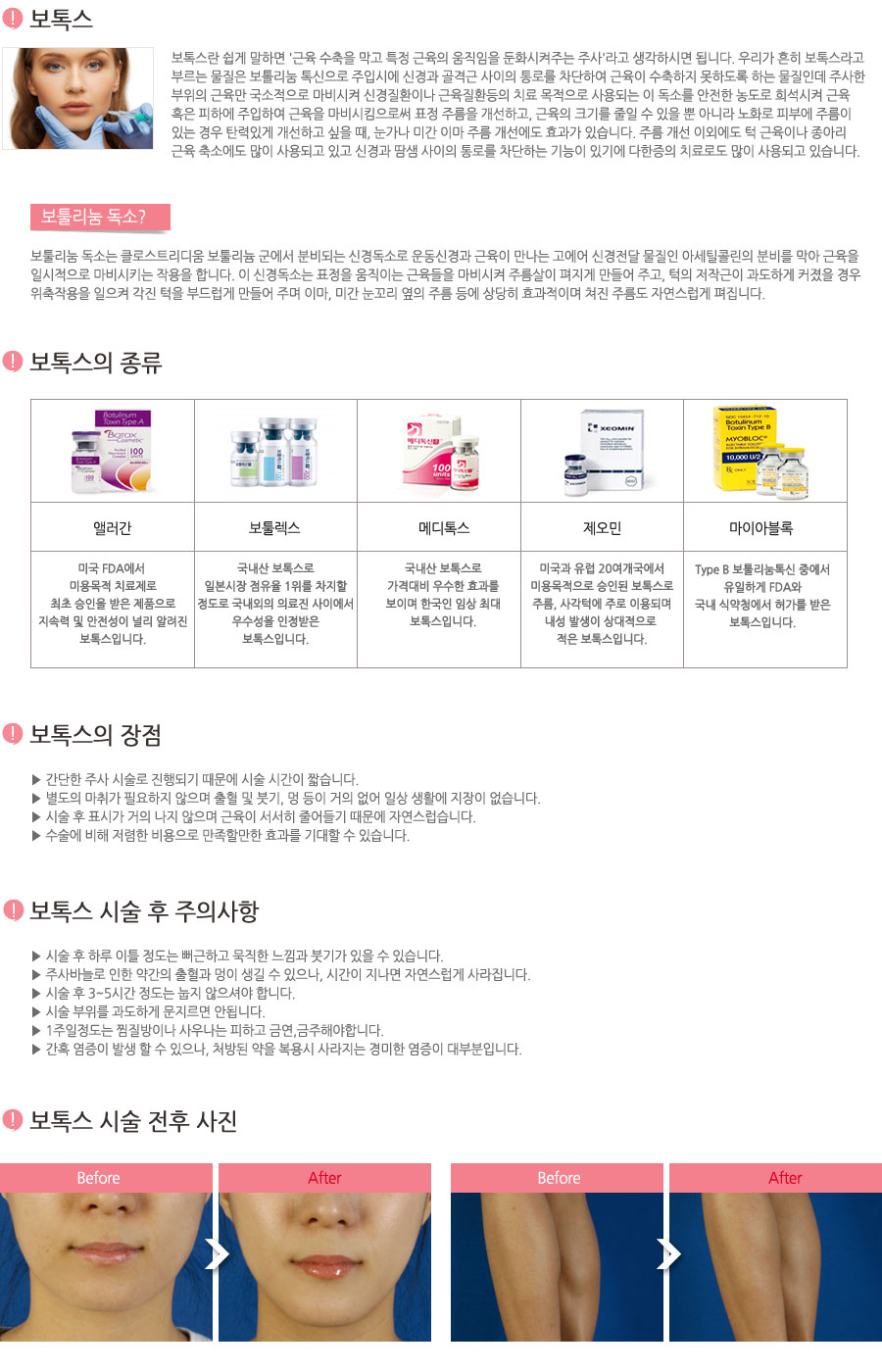 보톡스란 쉽게 말하면 ‘근육 수축을 막고 특정 근육의 움직임을 둔화시켜주는 주사’ 라고 생각하시면 됩니다. 우리가 흔히 보톡스라고 부르는 물질은 보톨리눔 톡신으로 주입시에 신경과 골격근 사이의 통로를 차단하여 근육이 수축하지 못하도록 하는 물질인데 주사한 부위의 근육만 국소적으로 마비시켜 신경질환이나 근육질환등의 치료 목적으로 사용되는 이 독소를 안전한 농도로 희석시켜 근육 혹은 피하에 주입하여 근육을 마비시킴으로써 표정 주름을 개선하고, 근육의 크기를 줄일 수 있을 뿐 아니라 노화로 피부에 주름이 있는 경우 탄력있게 개선하고 싶을 때, 눈가나 미간 이마 주름 개선에도 효과가 있습니다. 주름 개선 이외에도 턱 근육이나 종아리 근육 축소에도 많이 사용되고 있고 신경과 땀샘 사이의 통로를 차단하는 기능이 있기애 다한증의 치료로도 많이 사용되고 있습니다. 