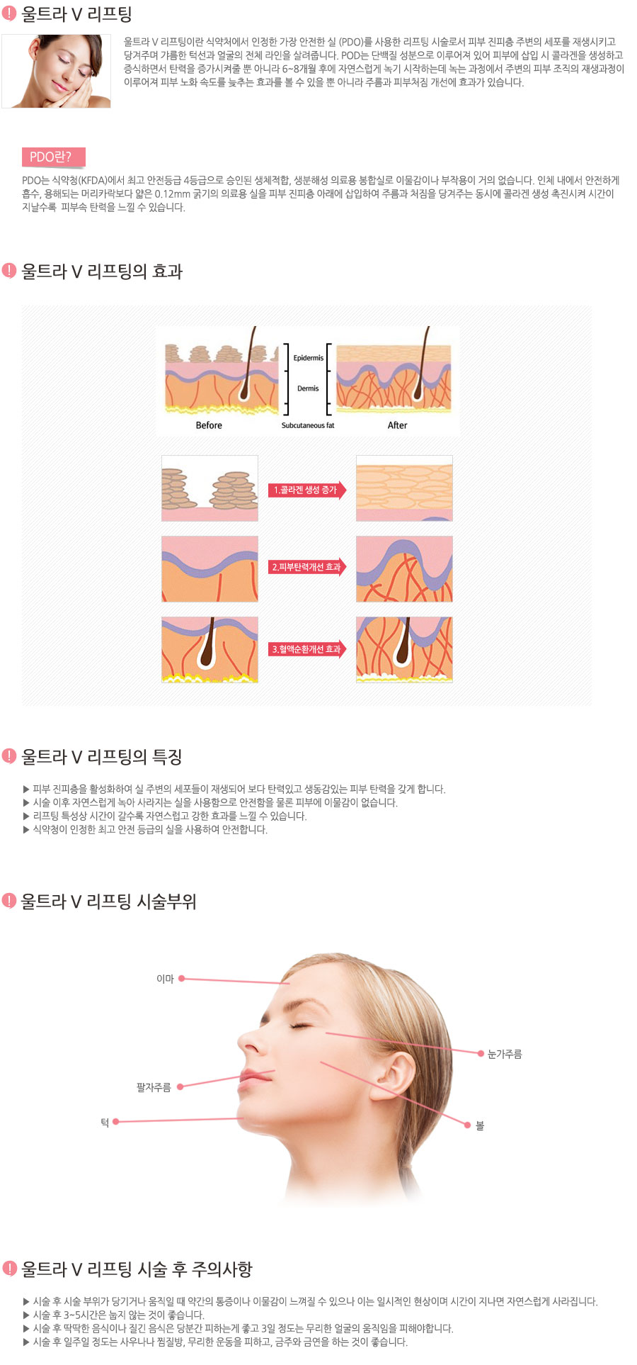 울트라 V 리프팅이란 식약처에서 인정한 가장 안전한 실 (PDO)를 사용한 리프팅 시술로서 피부 진피층 주변의 세포를 재생시키고 당겨주며 갸름한 턱선과 얼굴의 전체 라인을 살려줍니다. POD는 단백질 성분으로 이루어져 있어 피부에 삽입 시 콜라겐을 생성하고 증식하면서 탄력을 증가시켜줄 뿐 아니라 6~8개월 후에 자연스럽게 녹기 시작하는데 녹는 과정에서 주변의 피부 조직의 재생과정이 이루어져 피부 노화 속도를 늦추는 효과를 볼 수 있을 뿐 아니라 주름과 피부처짐 개선에 효과가 있습니다.